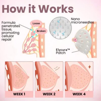 Elycura dissolving microneedle patch